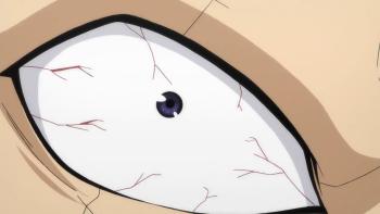 Episodio 20
